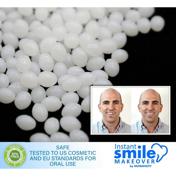 16 Packs of Instant Smile Fitting Beads & Case - Picture 3 of 5